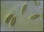 diatom1
