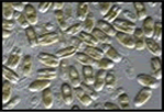 diatom2